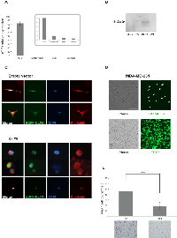 Figure 4:  Forced expression of KLF9  alters cell morphology and impairs breast cancer cell invasion.