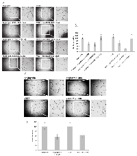 Figure 4:  trT2-50m and peptides A103-Q159 (57aa) and K108-K133 (26aa) inhibit angiogenin- and VEGF- induced  HUVEC tube formation on Matrigel. 