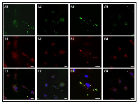 Figure 6: Peptide K108-K133 co-localize with angiogenin in HUVECs. 