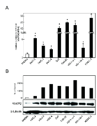 Figure 1: Overexpression of WWP2 in OSCC-derived  cell lines. 