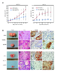 Figure 5:  shWWP2 inhibits tumoral growth in vivo . 