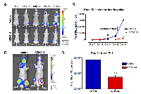 Figure 1: AZD6244 treatment slowed the growth of bone metastases. 