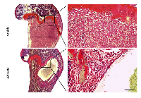 Figure 2:  AZD6244 treatment led to the formation of apoptotic cavities within established bone metastases. 