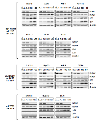 Figure 5:  Effect of MDM2  knockdown on expression levels of MDM2, MDM4, p53 and p21. 