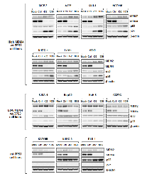 Figure 6:  Effect of MDM4  knockdown on expression levels of MDM4, MDM2, p53, and p21. 