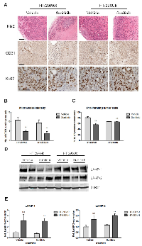 Figure  3:  Immunohistochemical  stainings  and  CD31,  Ki-67  and  LAMP-1  and  -2  quantification. 