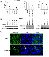 Figure 1: AVL9, DENND5A and NUPL1 are knocked down in MDCKII cells via shRNA. 