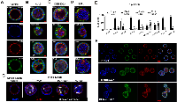 Figure 2:  Each gene-knockdown alters cyst structures. 