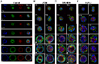 Figure 3:  Abnormalities in target gene knockdown clones start at the first cell division and persist throughout the  entire cystogenesis process. 