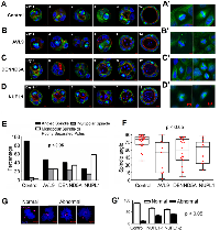 Figure 4:  Target gene knockdown clones develop abnormal spindles and other defects. 