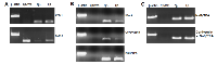 Figure 8:  Effect of cordycepin on EBV latency promoter selection. 