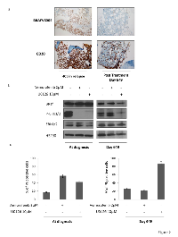 Figure 2:  Vemurafenib reduces the number of HCL in bone marrow and leads to a decrease of MAPK pathway  activation. 