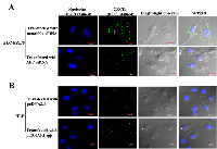 Figure 2:  Influence of AFP on the expression of CXCR4 in PLC/PRF/5 cells and HLE cells observed by laser confocal  microscopy. 