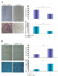 Figure 7:  Effects of AFP knockdown or overexpression on wound healing and migration of PLC/PRF/5 and HLE cells. 