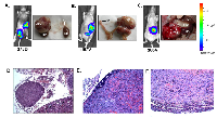 Figure 2: Soft tissue metastases following intracardiac inoculation of H1299-luc2 cells. 