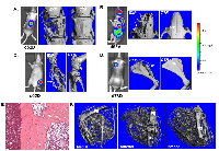 Figure 3:  µCT imaging of skeletal metastases and tumor vasculature. 