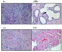 Figure 4:  TR4 increases prostate trans-differentiation in PPARG null normal prostate epithelial cell. 