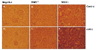 Figure 11:  Kidney biopsies from normal kidney (control) and ccRCC patients were stained with anti-NNMT and anti- NR3C1 antibodies. 