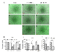 Figure 3:  Effect of miR-148a expression on the invasive potential of Daoy and D283 cell lines. 