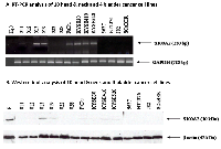 Figure 1: Expression of S100A2 in head/neck and bladder cancer cell lines. 