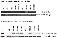 Figure 2:  Expression of S100A2  in head&neck cancer cell lines after treatment with 5-aza-2’-deoxycytidine. 