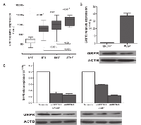 Figure 1: GRPR expression in prostate carcinomas and cell line models of ERG and ETV1 rearrangements. 