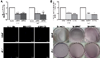 Figure 3:  Impact of GRPR  silencing in LNCaP and VCaP cell lines in invasion and anchorage-independent growth. 