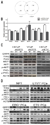 Figure 4:  Dissection of potential GRPR downstream targets. 