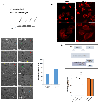 Figure 6:  MiR-31 overexpressing KF-TX cells show increased acetylated α-tubulin levels. 