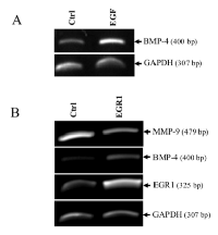 Figure 2:  BMP-4 expression in HT1080 cells by EGF/ EGR1. 