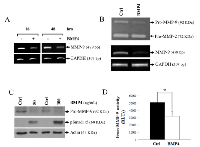 Figure 3:  MMP-9 is decreased following BMP-4 stimulation in HT1080 cells. 