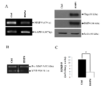 Figure 4:  De novo  expression of BMP-4 reduces MMP- 9 gene expression. 