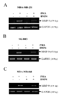 Figure 5:  MMP-9 expression is suppressed by BMP- 4 in MDA-MB-231, MDA-MB-468 and SKBR3 cells. 
