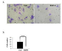 Figure 7:  BMP-4 inhibits in vitro  HT1080 cell  invasion. 