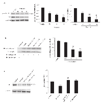 Figure 6:  Sorafenib induces degradation of the Akt protein in T24 BC cells. 