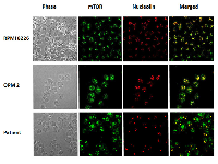 Figure 4:  Co-localization of mTOR antibody and nucleolin in RPMI8226, OPM2 cell lines and in CD138 + cells. 