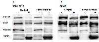 Figure 7:  Pomalidomide strengthens cytoplasmic-nuclear shuttling of mTOR and p-mTOR protein in RPMI8226 (A)  and OPM2 (B) cells. 