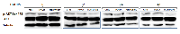 Figure 8: Pomalidomide does not affect AKT and p-AKT S473 levels in OPM 2 cells. 