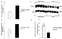 Figure 5:  Circadian disruption causes lowered expression of miRNAs 146a and 146b, and increased expression of  activated NF-κB. 