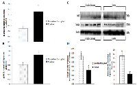 Figure 6:  Circadian disruption causes decreased expression of miR-127, and increased expression of Tudor-SN and  BCL6. 