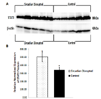 Figure 7:  Circadian disruption causes increased expression of STAT3. 