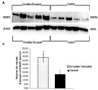 Figure 8:  Circadian disruption causes increased expression of DNMT1. 
