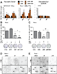 Figure 1: ART induces specific, iron-depended PCD in pancreatic cancer cell lines. 