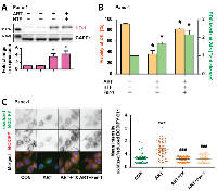 Figure 6:  Ferroptosis in Panc-1 cells is characterized by lipid peroxidation. 