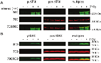 Figure 1: Effect of singleplex and multiplex antibody combinations on ATM (A) and H2AX (B) protein detection.