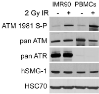 Figure 6:  Protein expression after irradiation.
