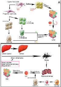 Figure 2:  Hepatic stem cells in liver regeneration and HCC (adapted from Yin C et al, 2013; Carpino G et al,  2012). 