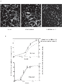 Figure 4:  Comparison of the abilities of paclitaxel and peloruside A to inhibit capillary tube formation. 