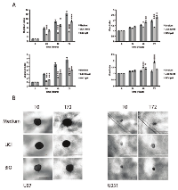 Figure 2:  The migratory abilities of U87 and U251 and spheroid core sizes are affected by treatment with the GSK-3 β  inhibitors. (A) 