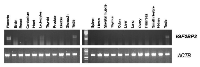Figure 1: Semi-quantitative analysis of IGF2BP3 expression in pooled RNA from normal human tissues.